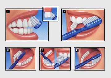 Правильная техника чистки зубов