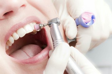 Ультразвуковая чистка зубов: почему она нужна каждому? 