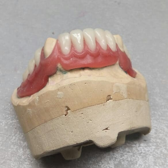 Постановка зубов на воске